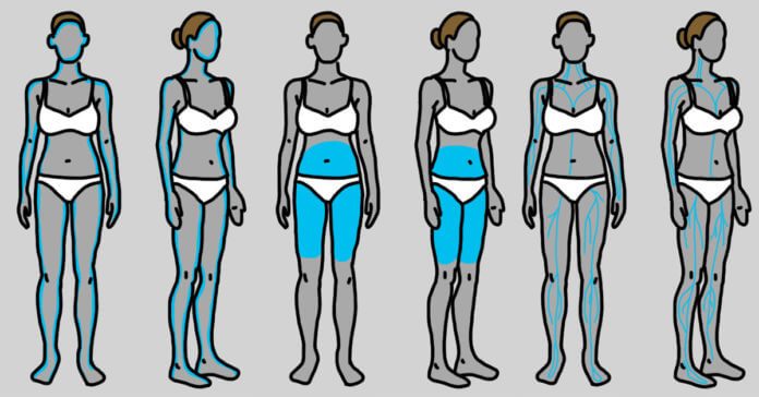 These are the symptoms of thyroid disease! Millions of women ignore this! thyroid disease