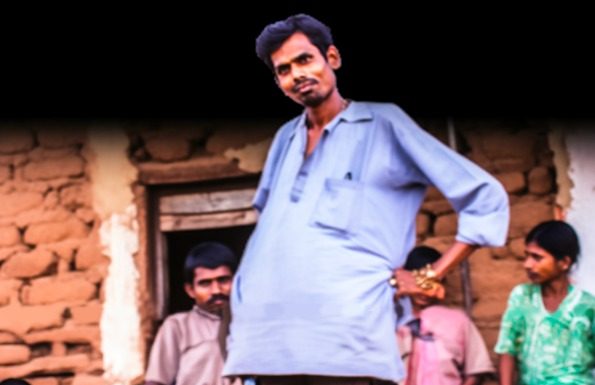 Man Went To Hospital For Check-Up – Then Doctor Looks At His X-Ray And Whispers: “I’m Sorry”