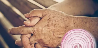 Aveți pete de vârstă pe piele? Acest truc simplu te poate ajuta să le reduci în cel mai scurt timp!